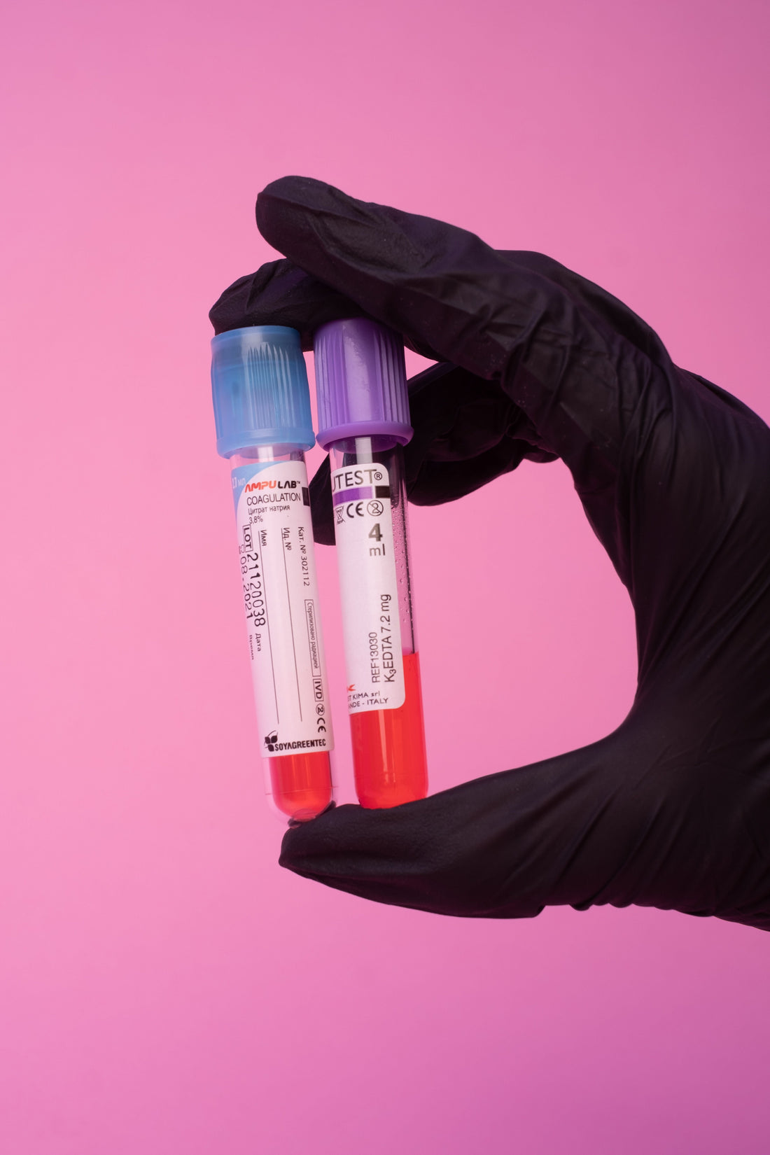 What Can a Blood Test Tell You About Your Health?