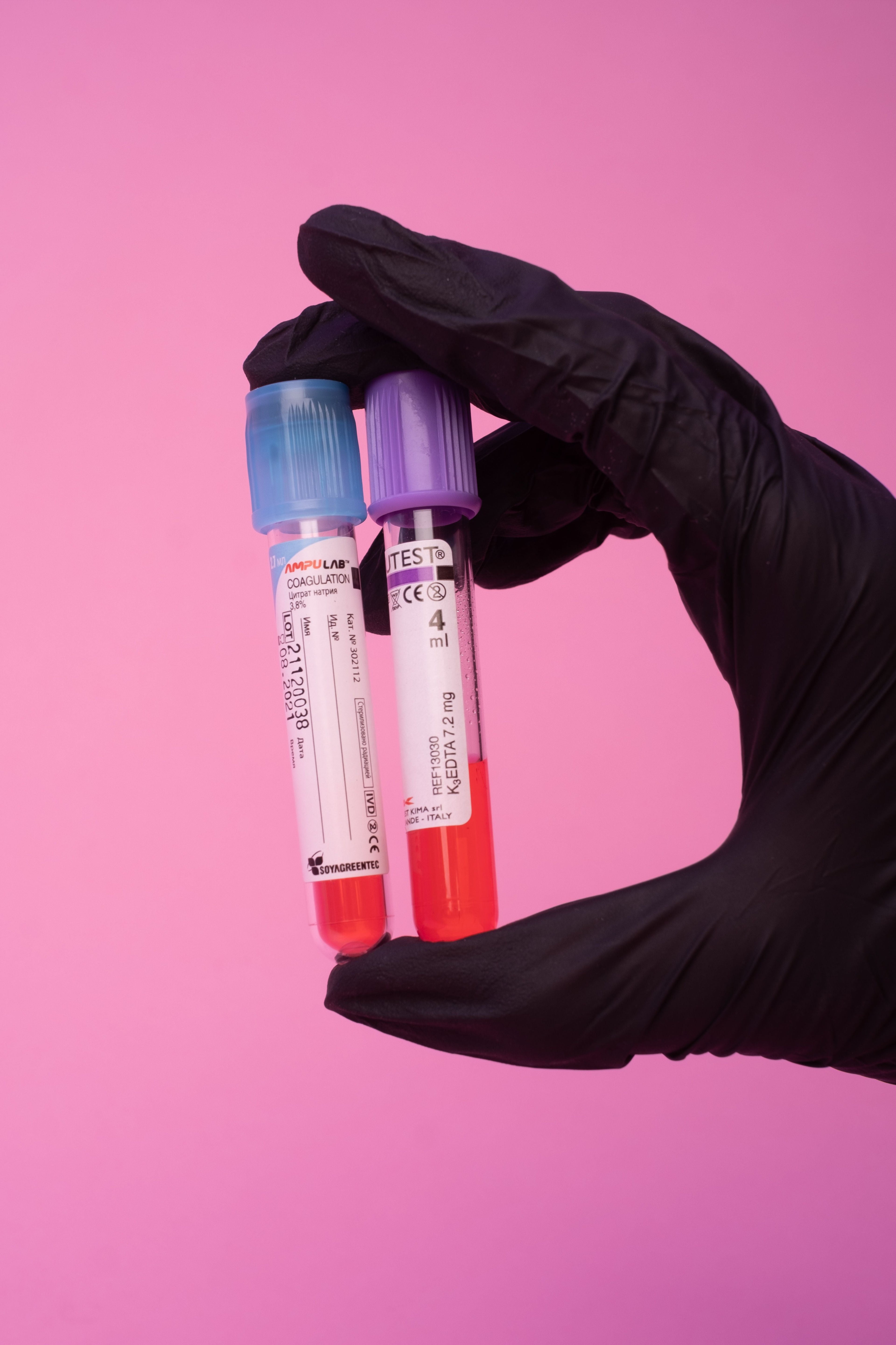 What Can a Blood Test Tell You About Your Health?